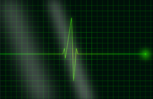 Understanding Large Language Models (LLMs): A Dive into the Heart of AI